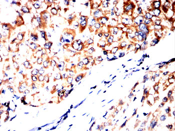 HTR3A Antibody