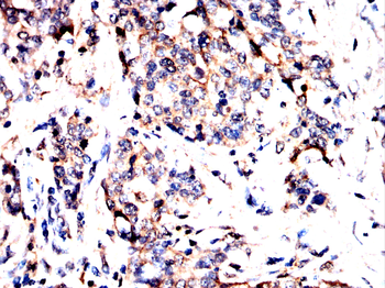 HTR3A Antibody