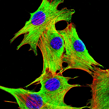 S100A9 Antibody