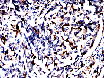 S100A9 Antibody