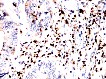 S100A9 Antibody