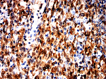 S100A9 Antibody