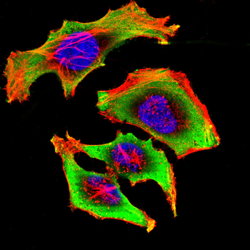 S100A9 Antibody