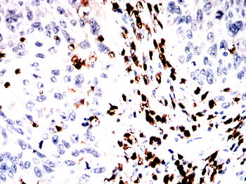 S100A9 Antibody