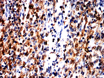 S100A9 Antibody