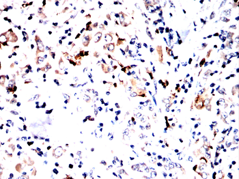 S100A9 Antibody