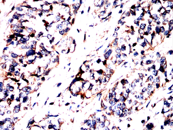 ANXA6 Antibody