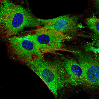 CHAT Antibody