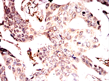 CHAT Antibody