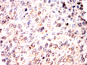 CHAT Antibody