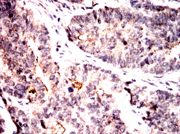 CHAT Antibody