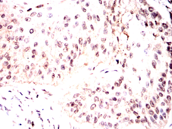 CHAT Antibody