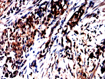 BCL11B Antibody