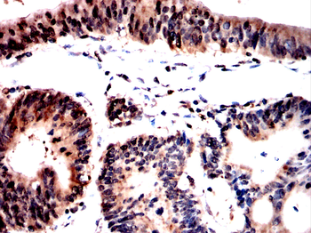 BCL11B Antibody