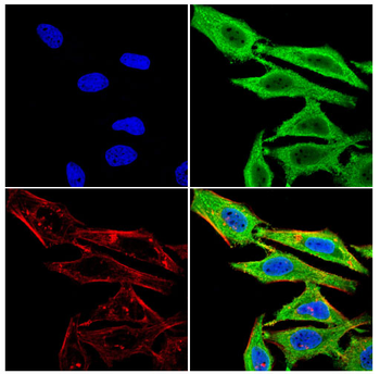 THBS1 Antibody