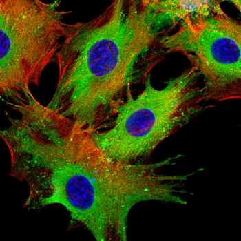 BCL11A Antibody