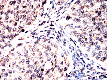 GRSF1 Antibody