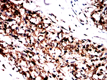 GRSF1 Antibody