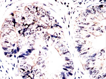 GRSF1 Antibody