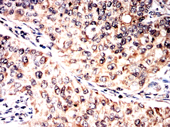 GRSF1 Antibody