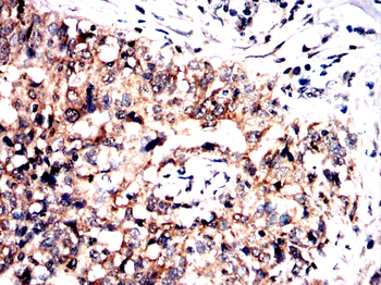 GRSF1 Antibody