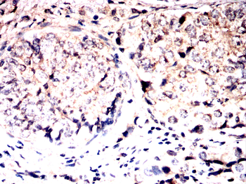 GRSF1 Antibody