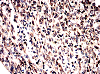 GRSF1 Antibody