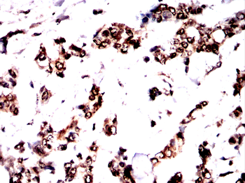 ARID3A Antibody