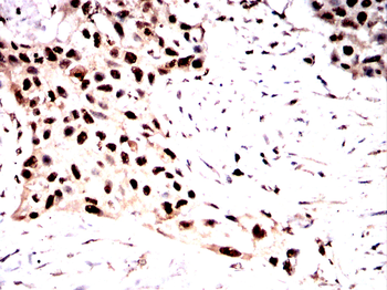 ARID3A Antibody