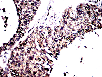 ARID3A Antibody