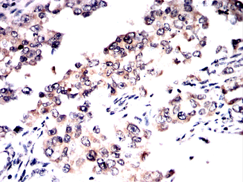 ARID3A Antibody