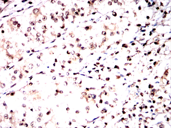FOXM1 Antibody