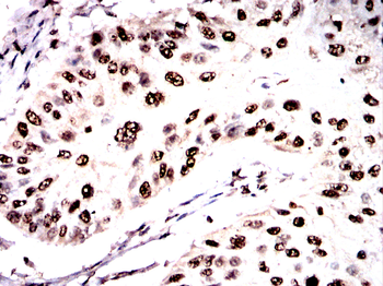 FOXM1 Antibody
