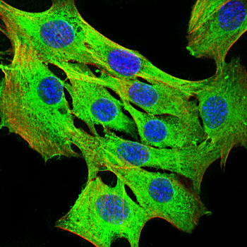 ROCK2 Antibody