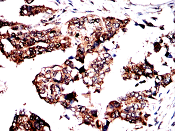 ROCK2 Antibody