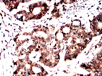 ROCK2 Antibody