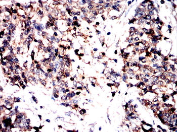 ROCK2 Antibody