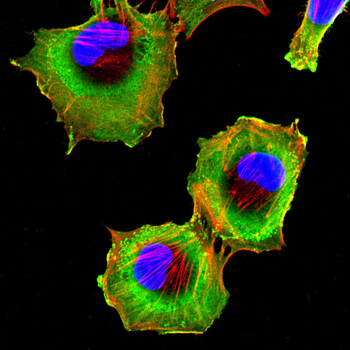 ROCK2 Antibody