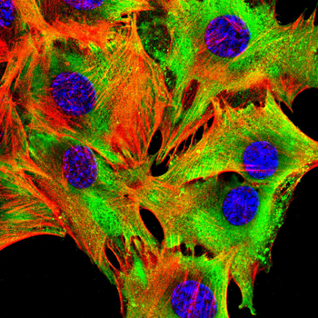 EIF2S1 Antibody