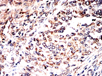 ACSL3 Antibody