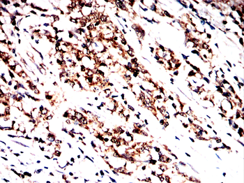 ACSL3 Antibody