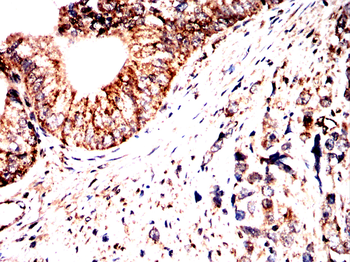 ACSL3 Antibody