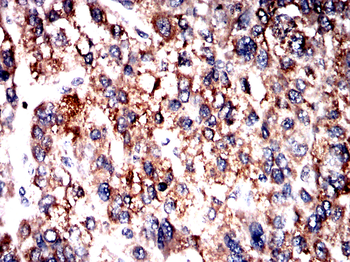 ACSL3 Antibody