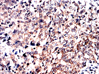 ACSL3 Antibody