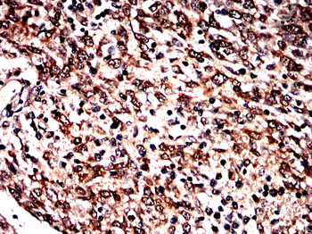 ACSL3 Antibody