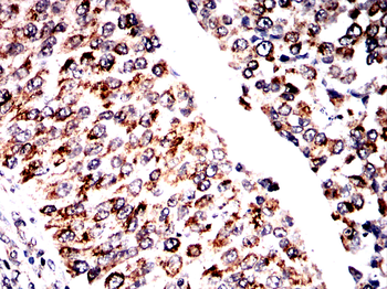 QKI Antibody