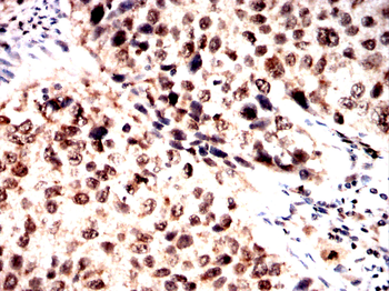 QKI Antibody
