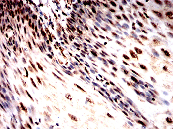 QKI Antibody