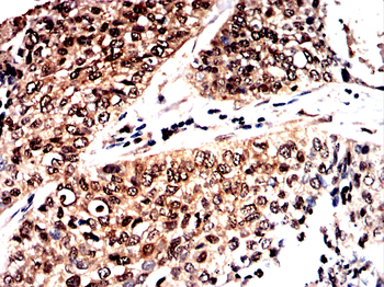 QKI Antibody