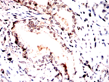 QKI Antibody
